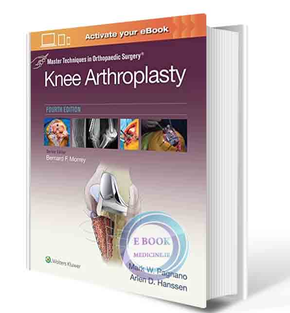 دانلود کتاب Master Techniques in Orthopedic Surgery: Knee Arthroplasty (Master Techniques in Orthopaedic Surgery) Fourth Edition2021 (ORIGINAL PDF)